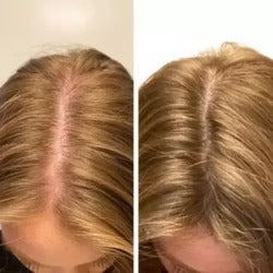 Vellora Light Scalp Massager Brush