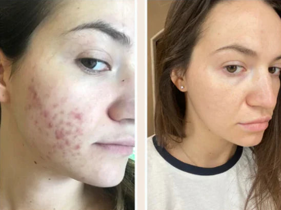 3 Pack | Collagen Face Mask