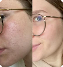 3 Pack | Collagen Face Mask